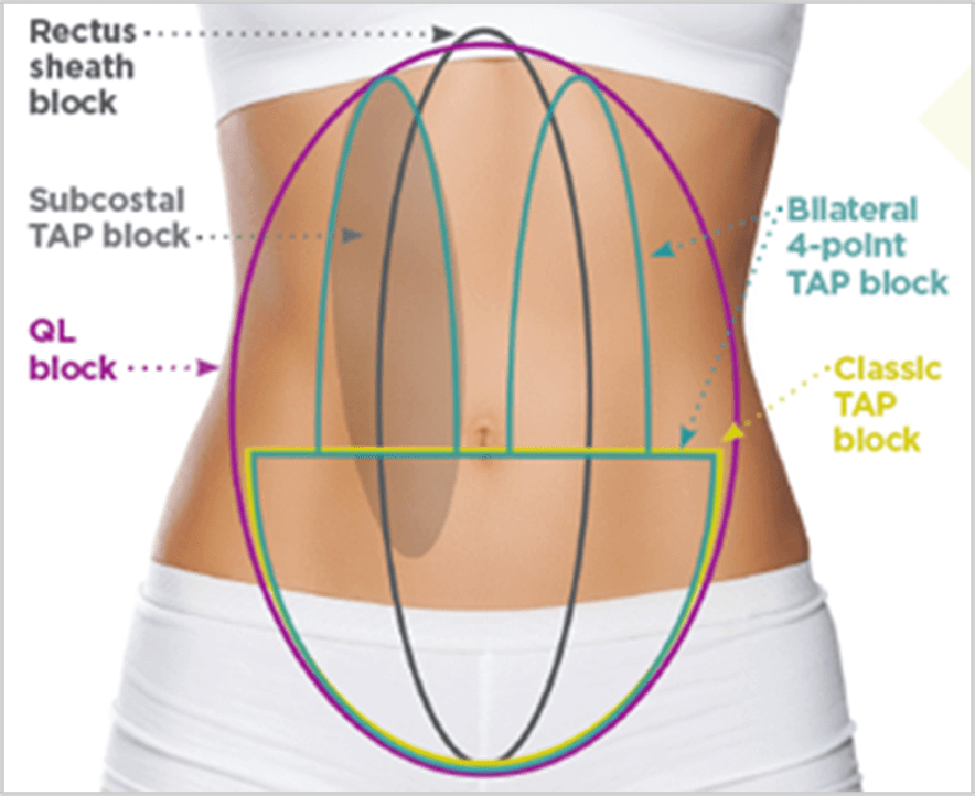 Abdominal Wall